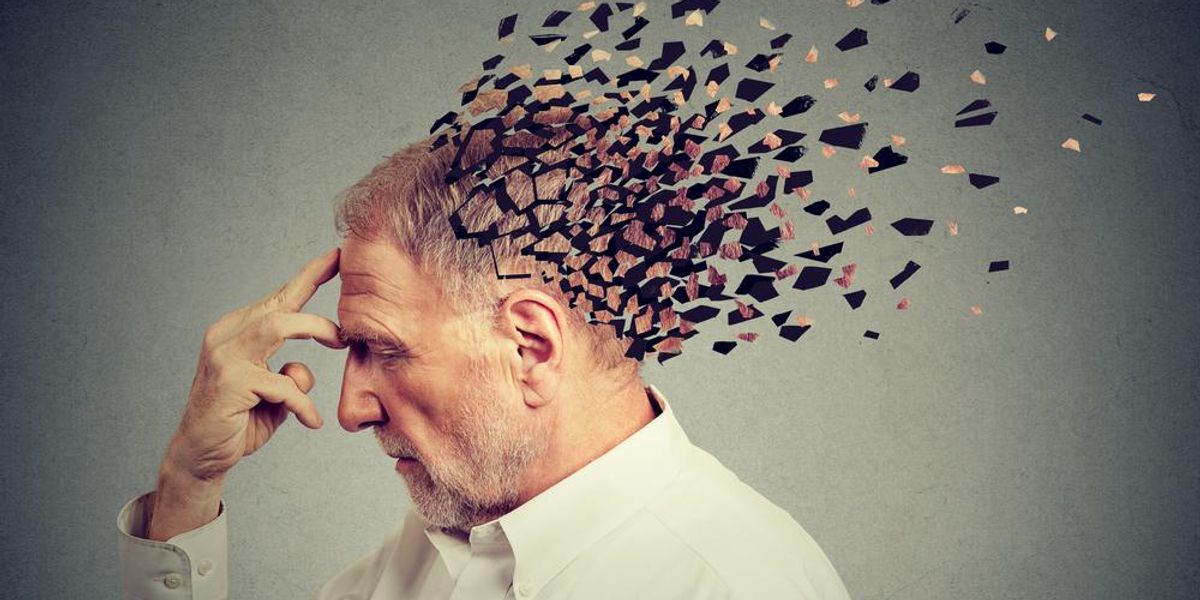 Memóriavesztés a demencia miatt. Idősebb férfi elveszíti a fej részeit, a csökkent elmefunkció szimbóluma.