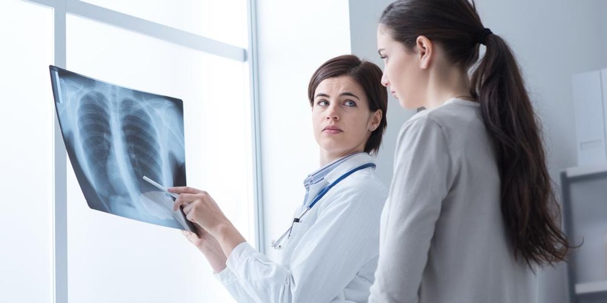 Női páciensnek tüdőröntgenjét mutató orvos