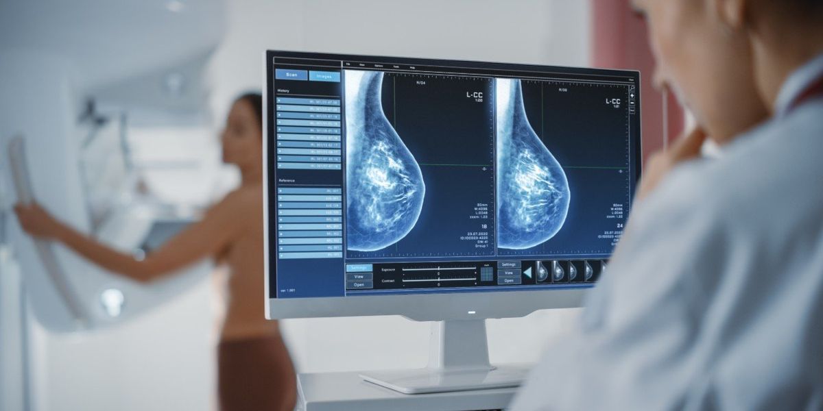 Mammográfiás felvételeket a számítógépen néző orvos