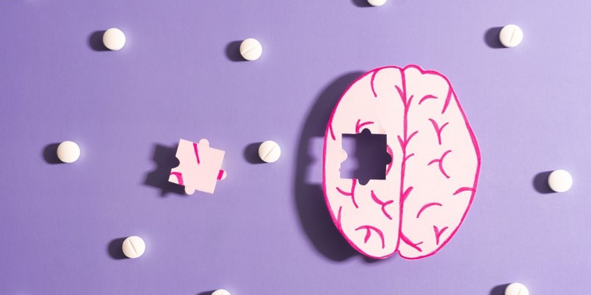 Emberi agy papírformábók, hiányzó puzzle – demencia, Alzheimer kór