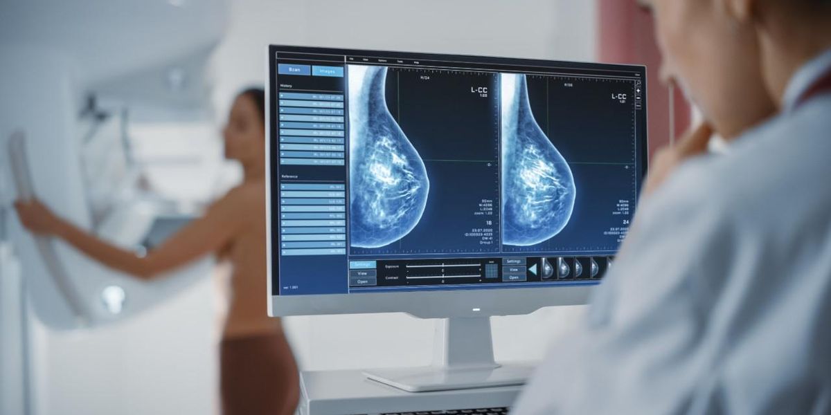 Mamográfiai vizsgálat