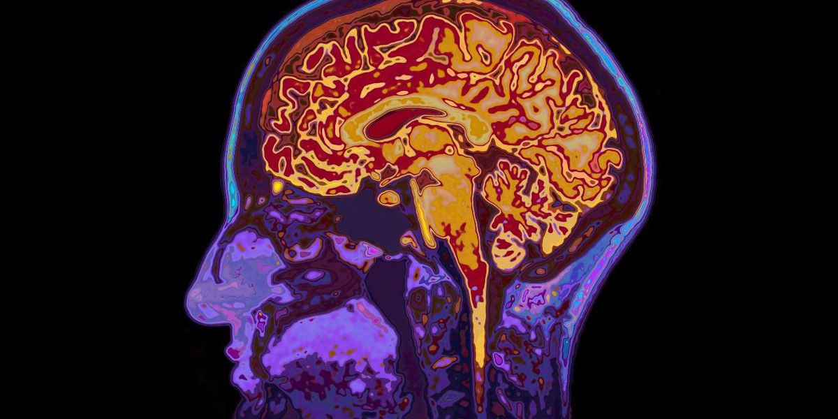 MRI-kép az emberi agyról