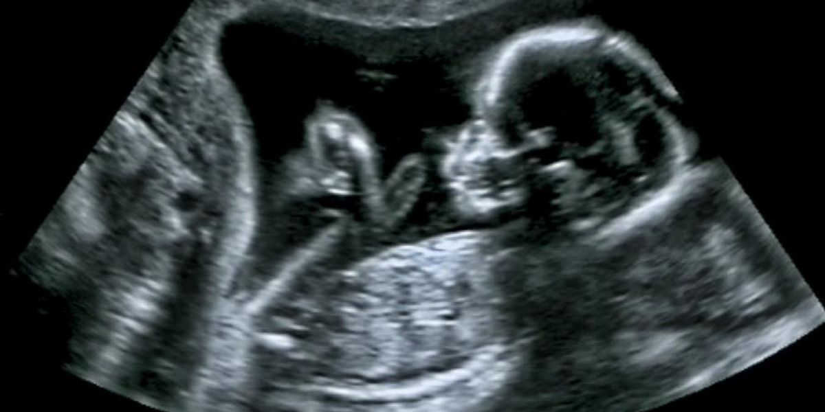 Ultrahangfelvétel az anya méhében lévő magzatról