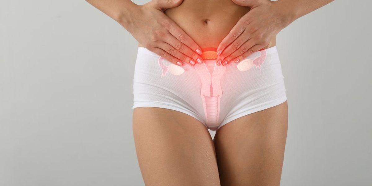 Endometriózis: számos genetikai kockázati tényezőre találtak