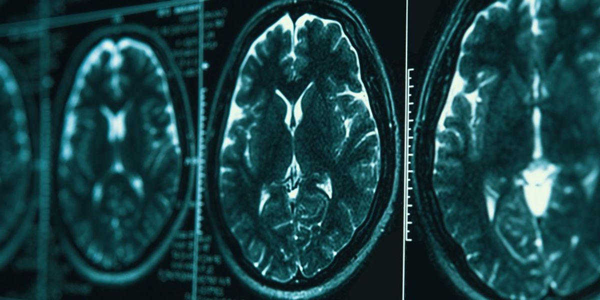MRI-kép a fejről és az agyról