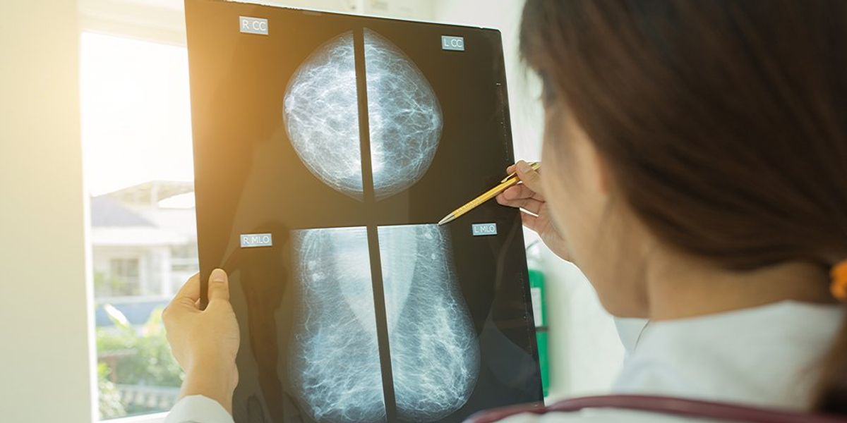 Mammográfia eredményét átnéző orvos
