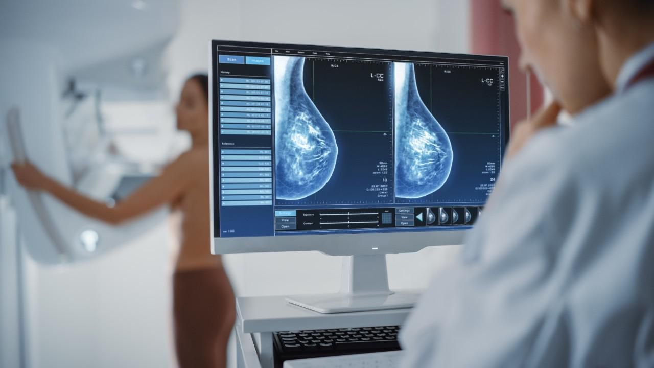 Mamográfiai vizsgálat
