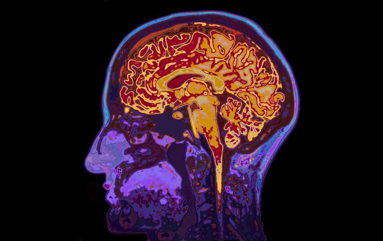 MRI-kép az emberi agyról
