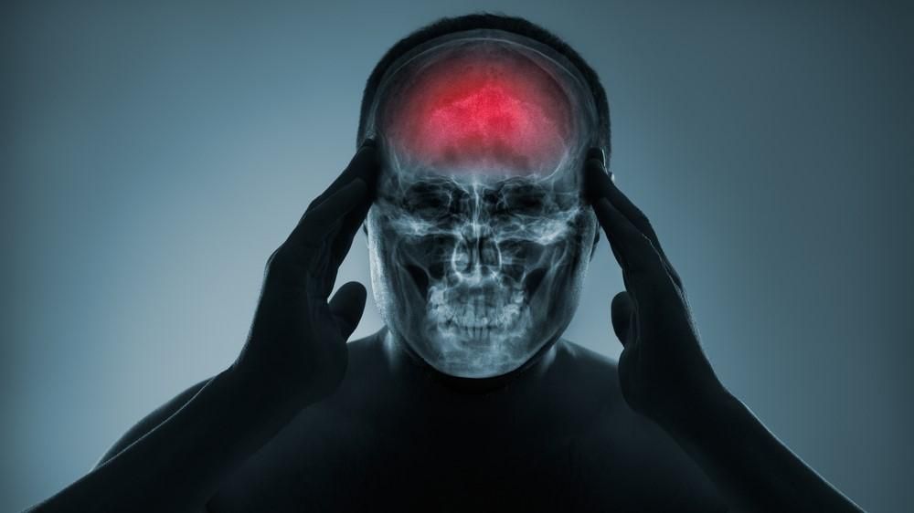 Egy ember fájó fejét illusztráló kép