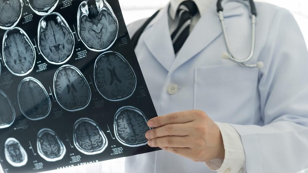 Egy orvos egy emberi agyról készített röntgenfelvételt néz