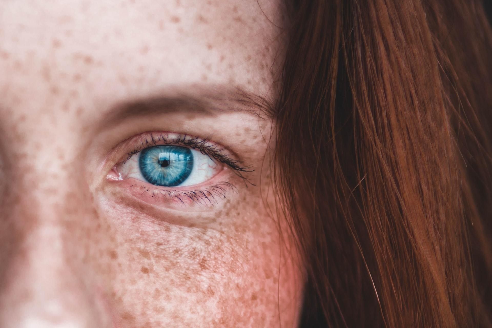 Szeplős nő kék szemmel