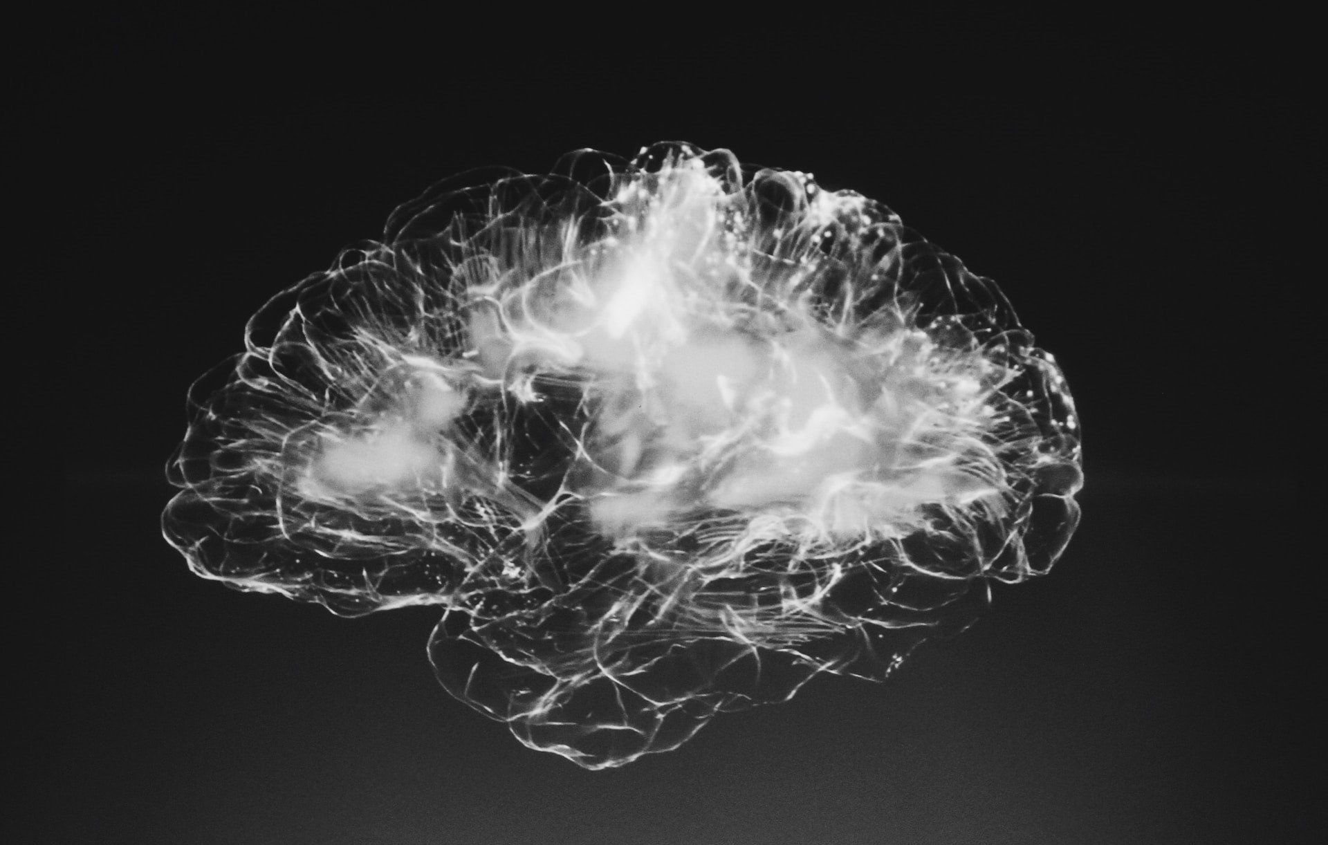 Fekete-fehér kép az agyról