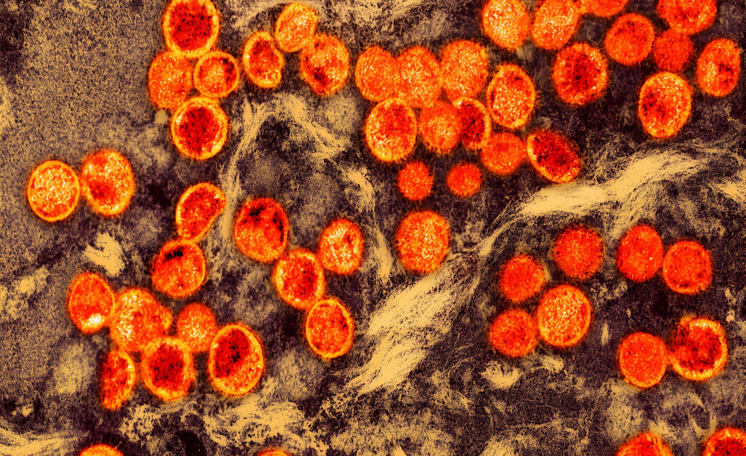 Más nevet kap a majomhimlő