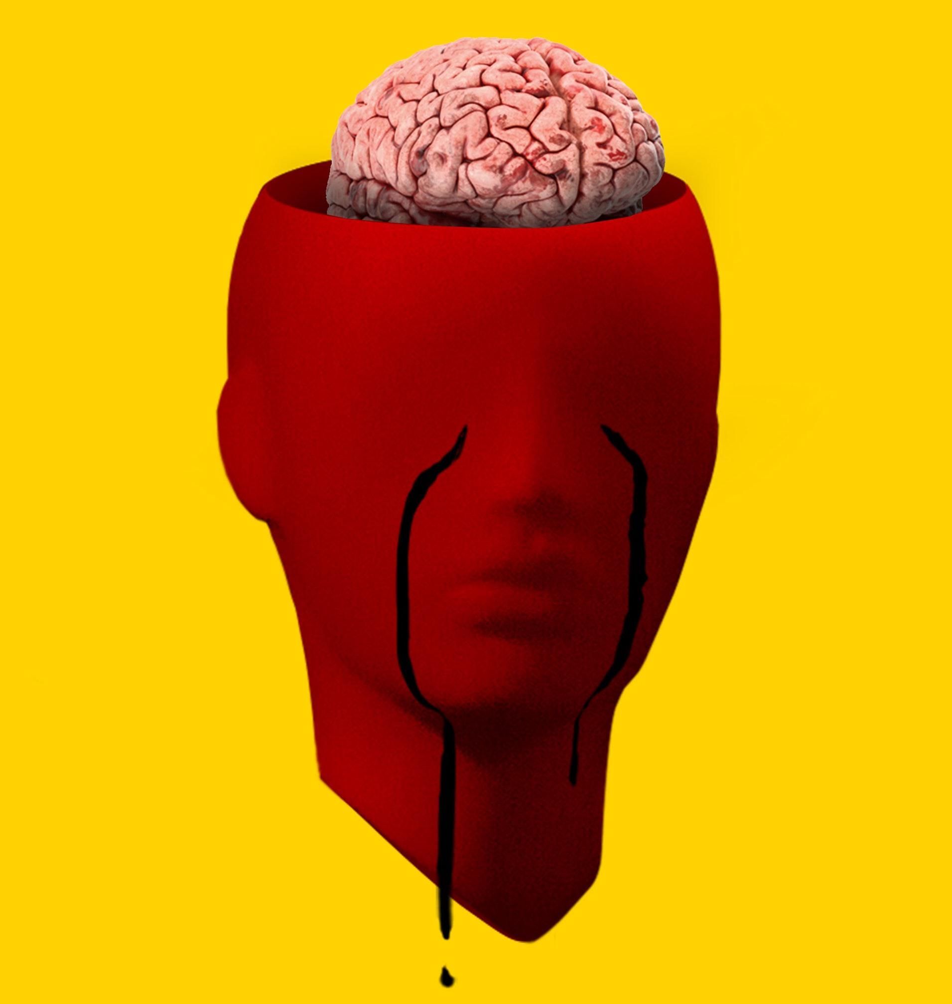 Hogyan késleltethető az Alzheimer-kór 5 évvel?