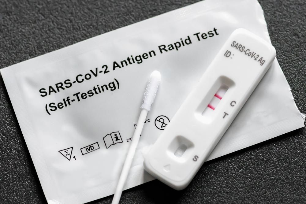 A koronavírus rengeteget rontott a környezetszennyezésen — Ez a fajta teszt lehet a megoldás
