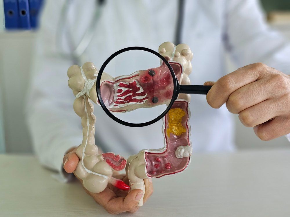 Egy ital napi fogyasztása akár 14%-kal is csökkentheti a bélrák kockázatát