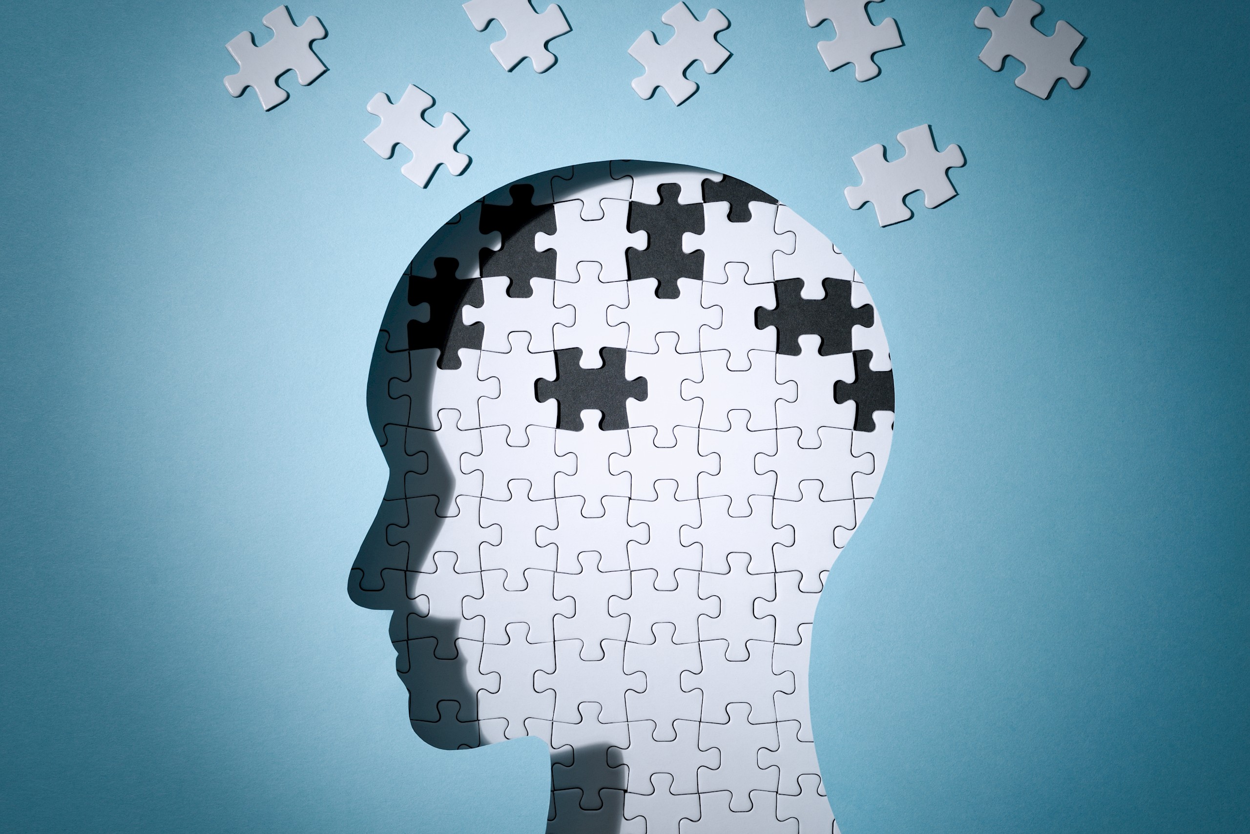 Mégsem működőképes az Alzheimer-kór legreméltebb kezelési módja