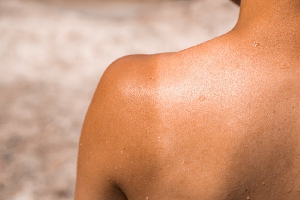 Már a felelőtlen barnulás is okozhat hosszabb távon bőrrákot