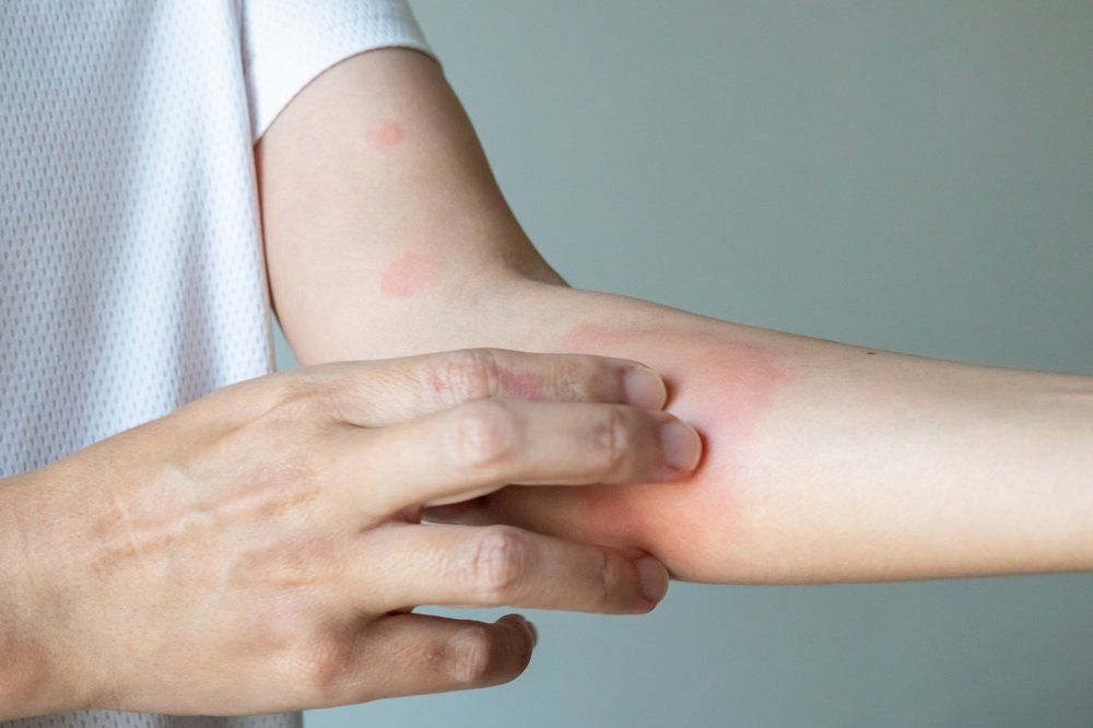 Pikkelysömör vagy ekcéma? Így tudjuk megkülönböztetni
