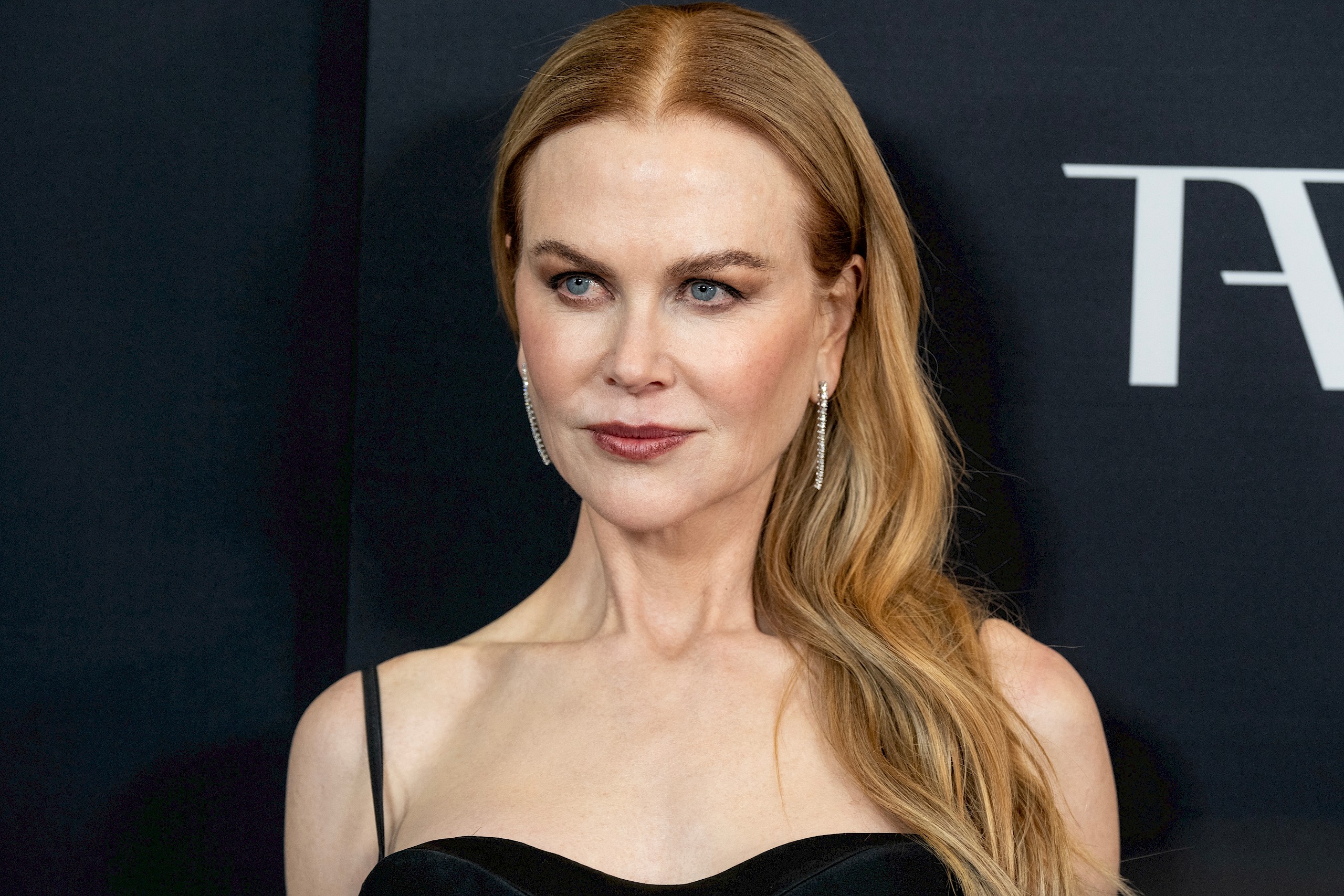 Nicole Kidmant kórházba kellett vinni, egy forgatáson lett rosszul