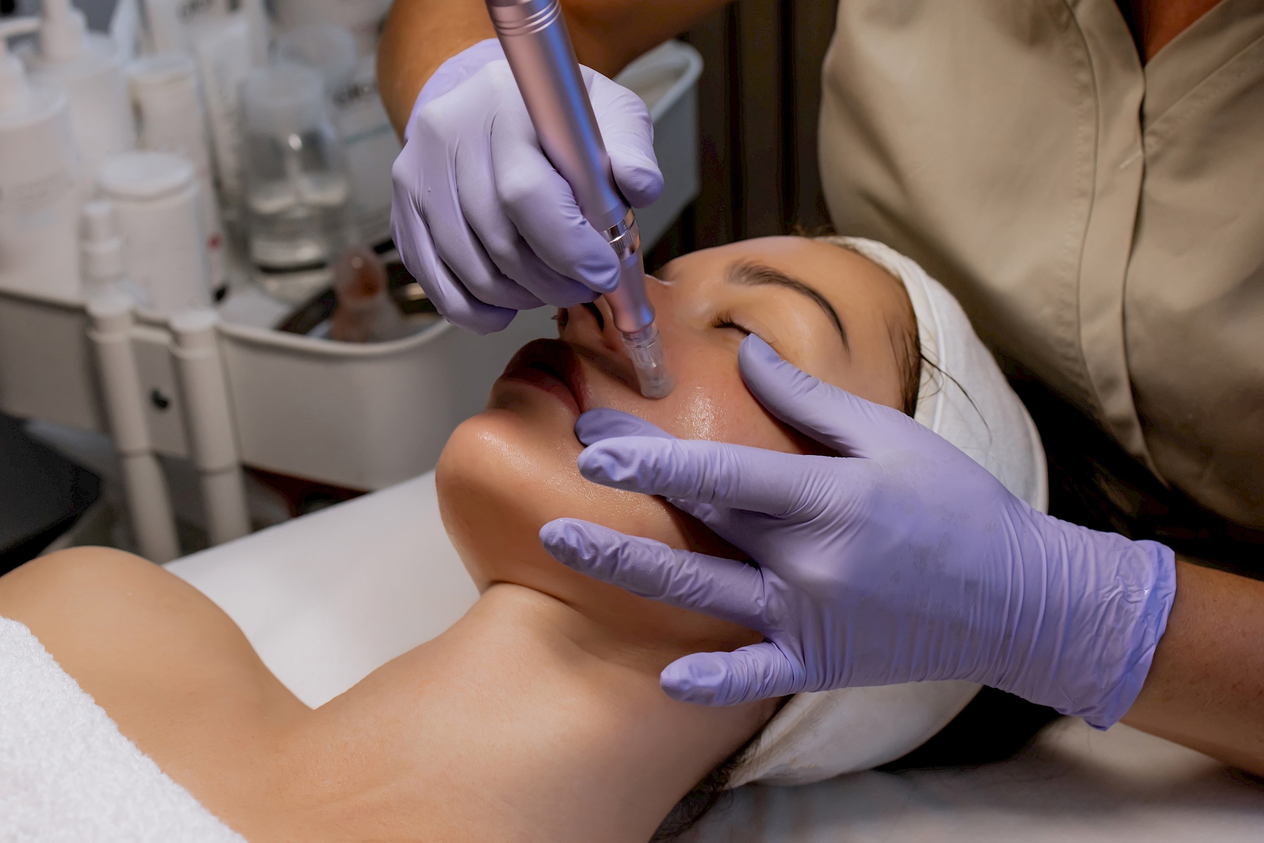 Mi az a microneedling? Így működik a népszerű bőrmegújító kezelés