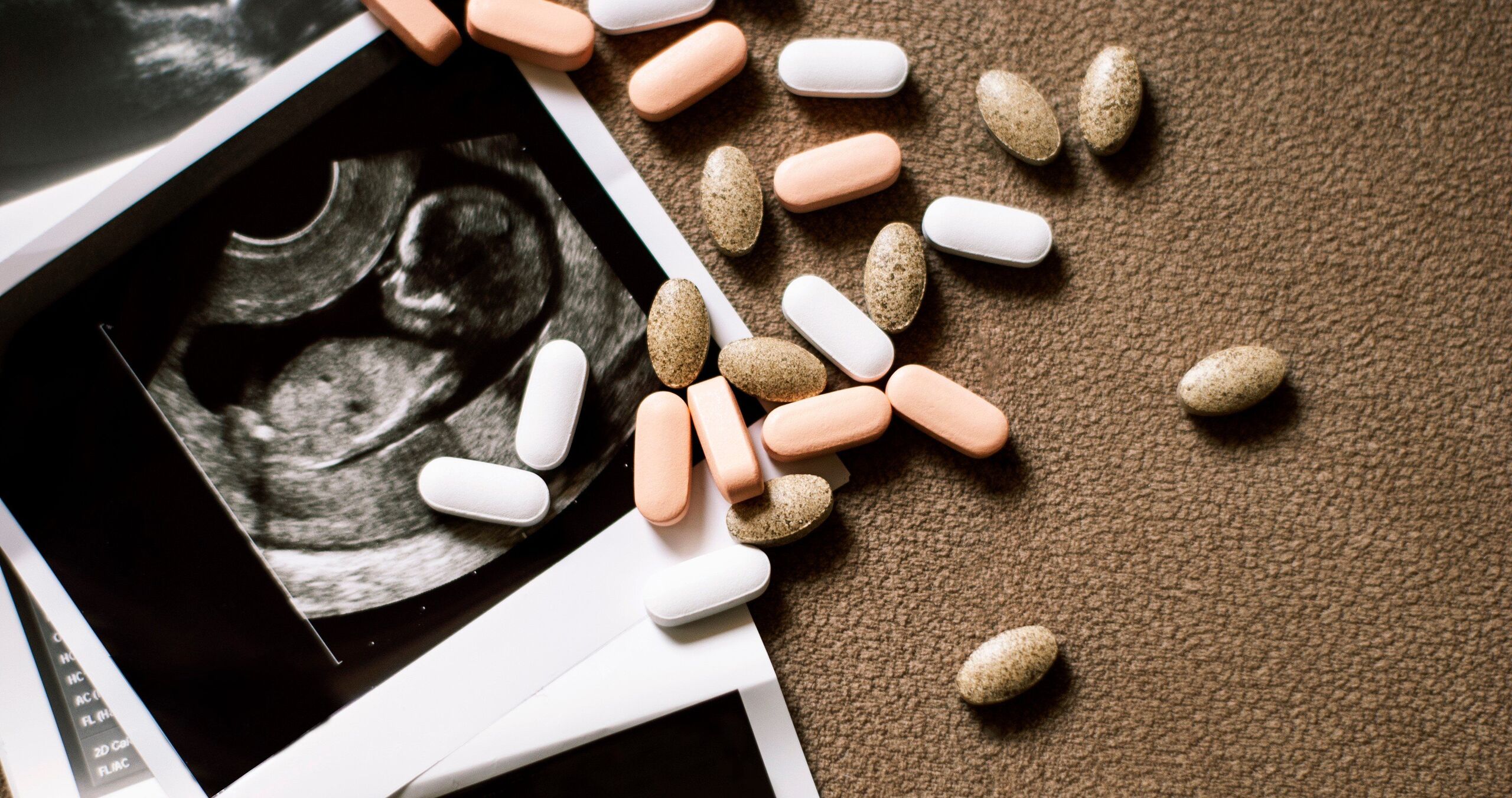 Börtönbüntetésre ítéltek egy nőt, mert túl későn vetette el a babáját